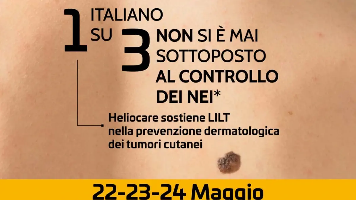 Tumori cutanei LILT: al via campagna nazionale e screening | Quotidiano di Ragusa